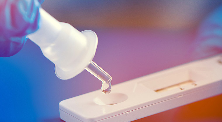 antigen-testing-covid-hiv